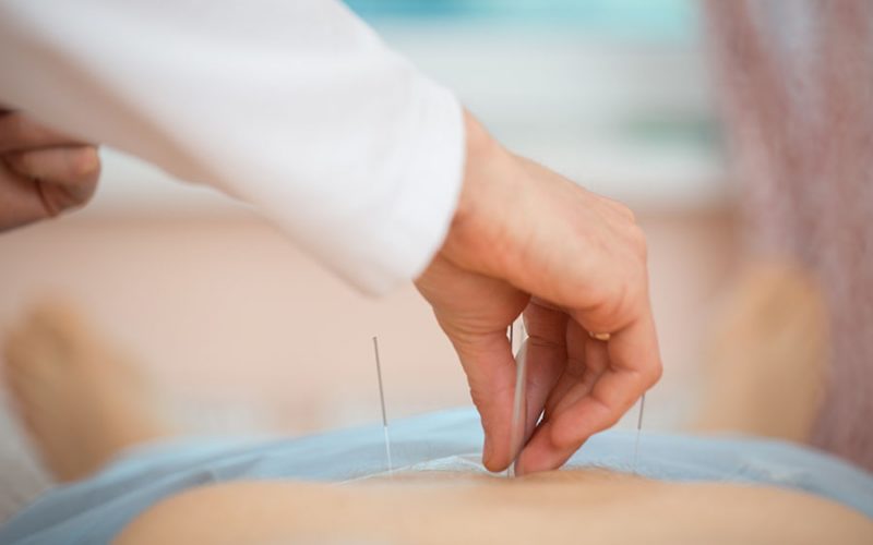 precise tcm acupuncture singapore needle placement